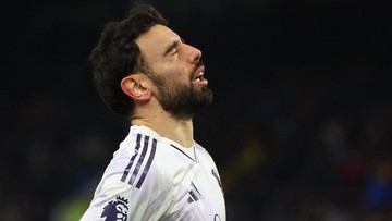 Burnley Vs Man United: 30 Tembakan ‘Mubazir’