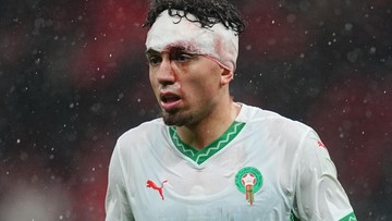 Momen Pemain Maroko Berdarah-Darah